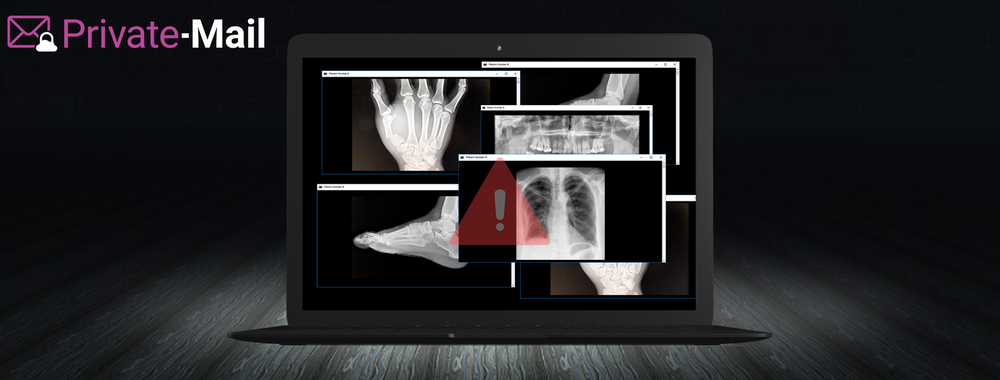 Millions of Americans’ X-Rays, MRIs, and CT Scans are Freely Available Online